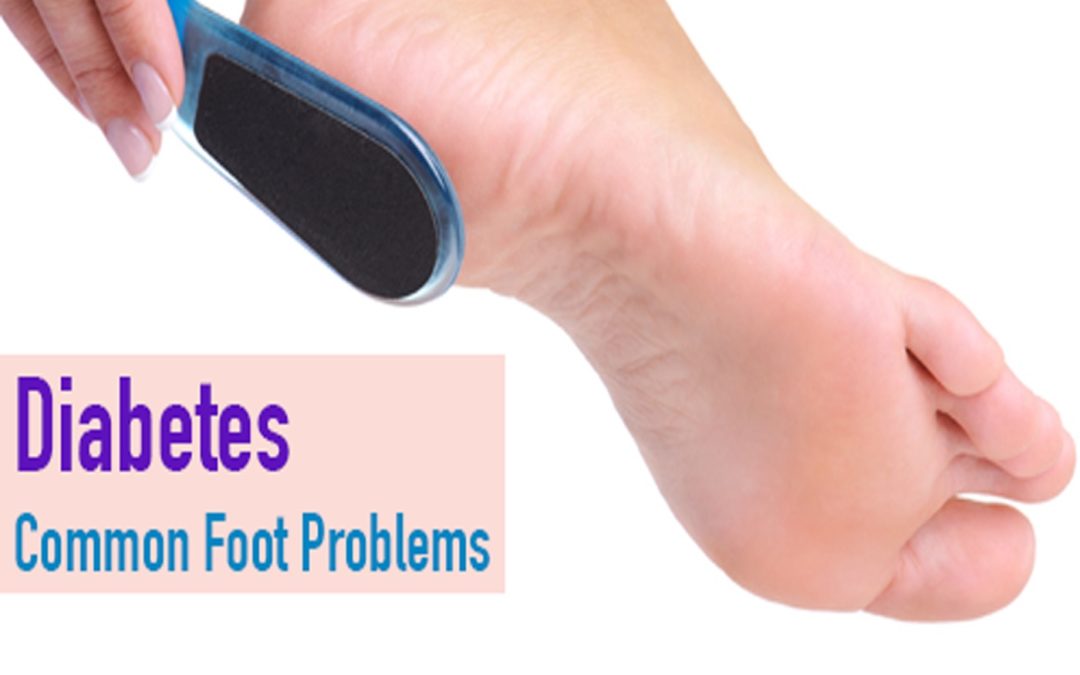 diabetic foot pain