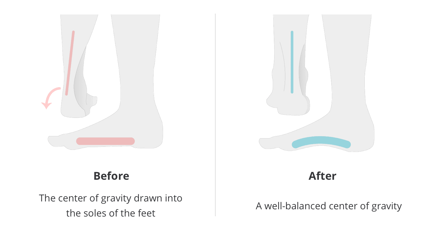flat feet body posture corrector