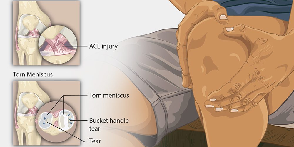 most commonly questions about knee pain answered