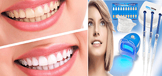 trendbaron teeth whitening kit banner